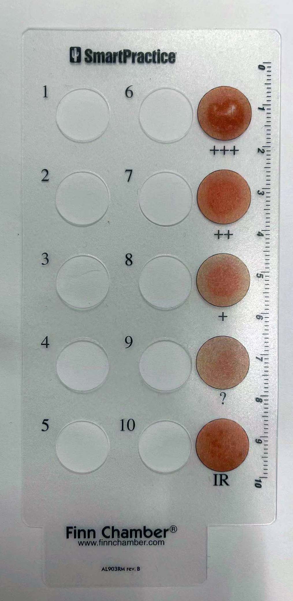 Finnchamber结果判读卡