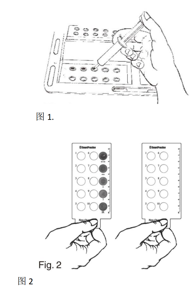 Finnchambers斑试器的使用方法